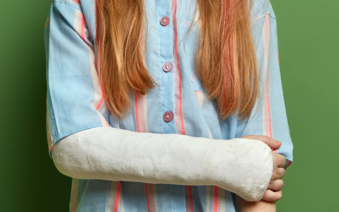 Kobieta z ręką w gipsie symbolizująca leczenie fibroartrozy
