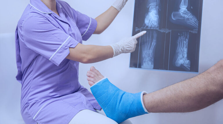Specjalista ortopedii pokazujący na zdjęciu rentgenowskim zmiany związane z fibroartrozą stawów
